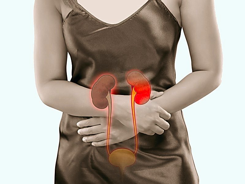 کلیه ناسالم