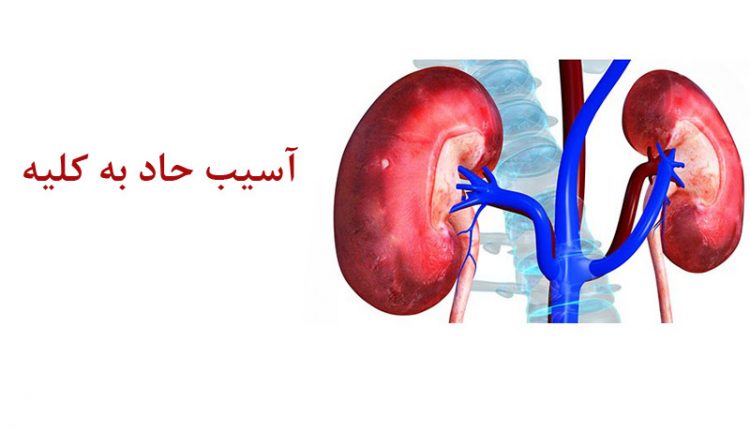 آسیب حاد کلیه