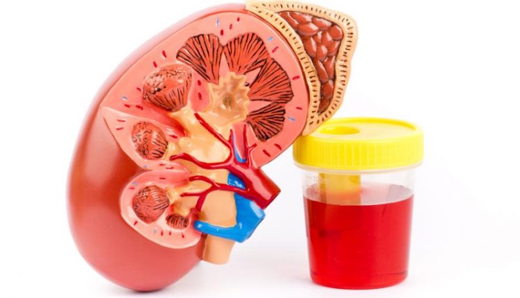 علت وجود خون در ادرار