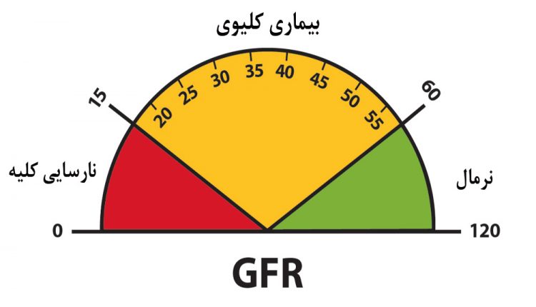 آزمایش GFR