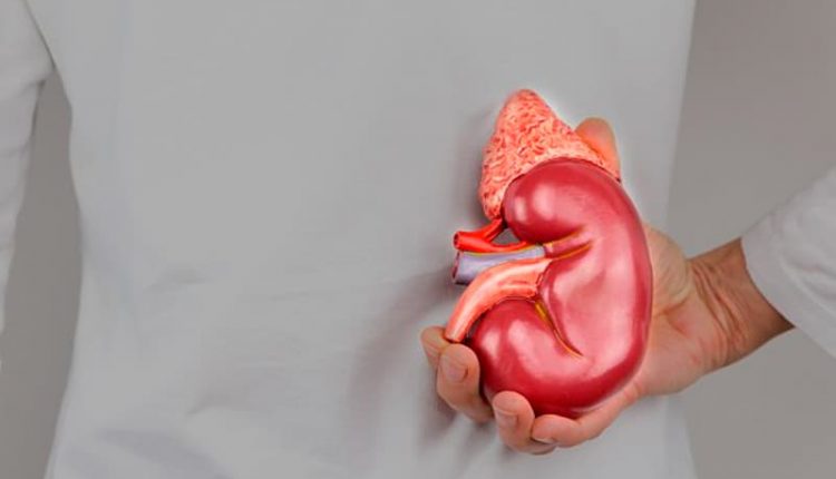 کیست ساده کلیه